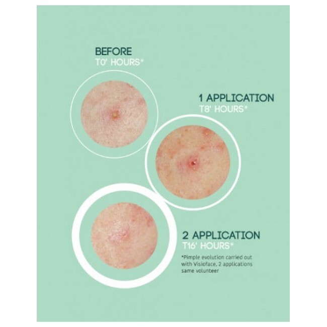 Iroha Nature - Pimple Patches SOS - 18 Stk - Billede 3